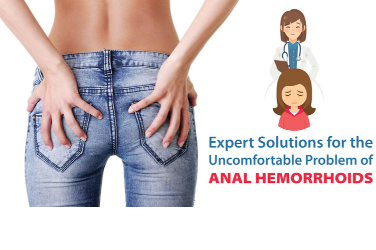 Expert Solutions for the Uncomfortable Problem of Anal Hemorrhoids