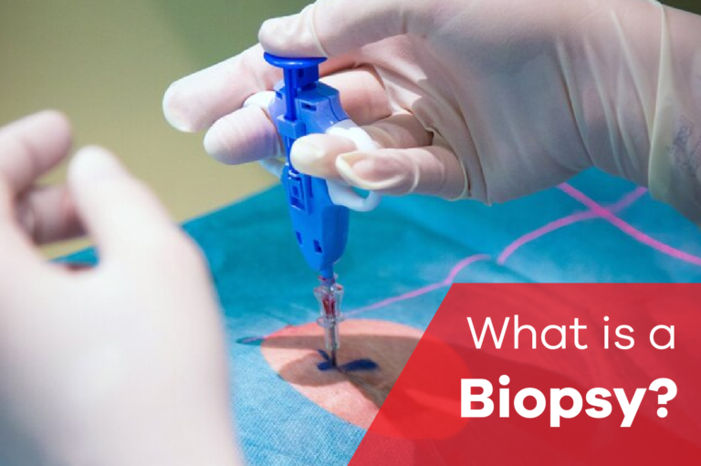 What is Biopsy?