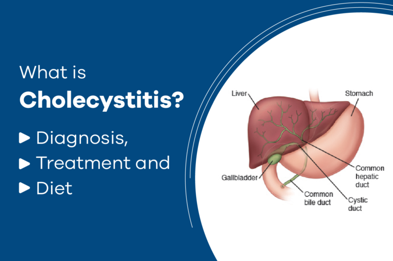 What is Cholecystitis? Diagnosis, Treatment and Diet