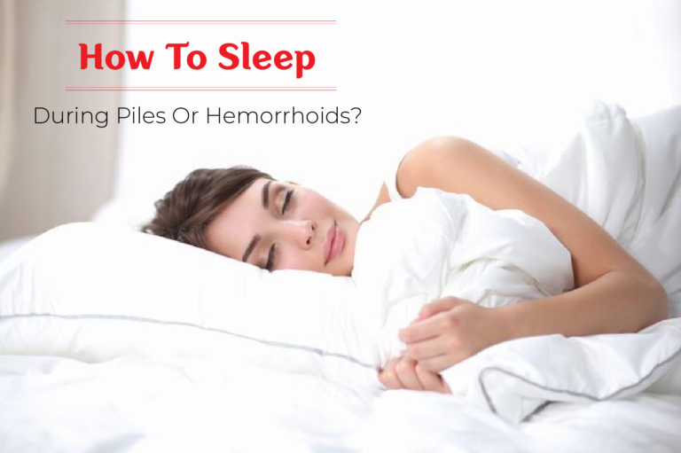 How to Sleep During Piles or Hemorrhoids?