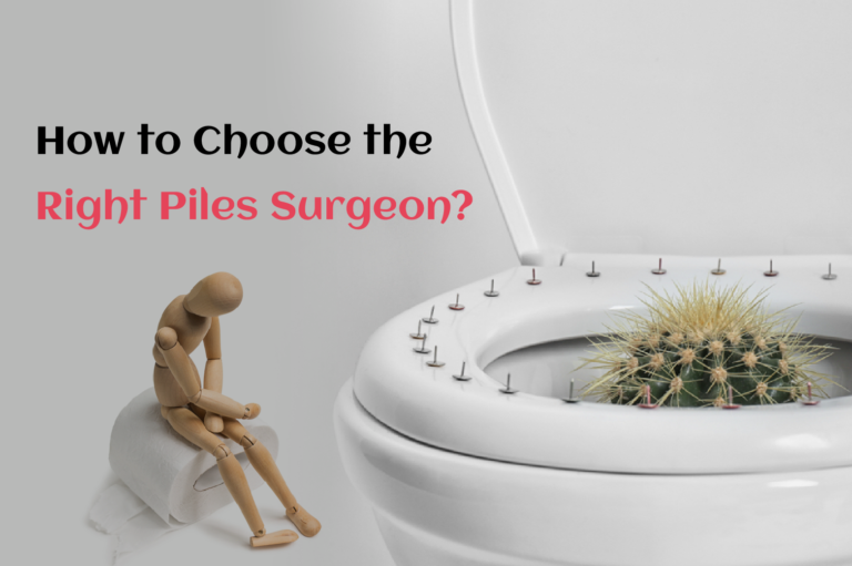 How to Choose the Right Piles Surgeon?