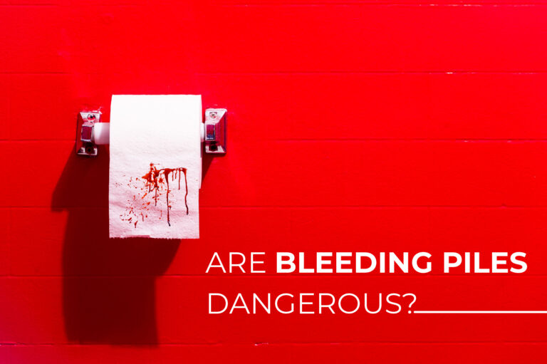 Are Bleeding Piles Dangerous