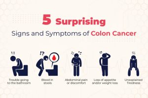 5 Surprising Signs and Symptoms of Colon Cancer