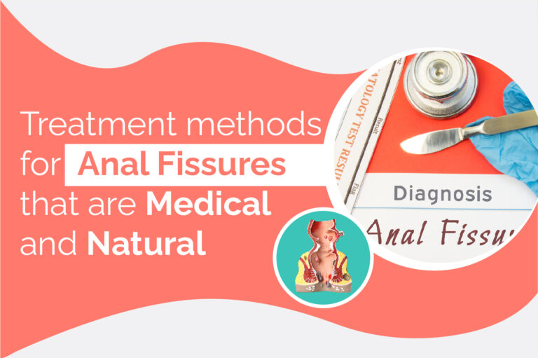 Treatment methods for anal fissures that are medical and natural