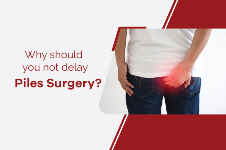 Why should you not delay piles surgery?