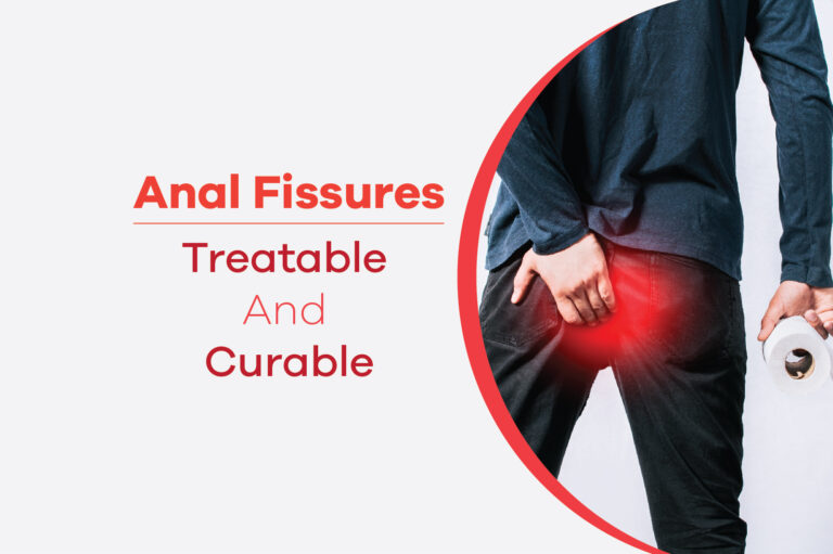 Anal Fissures–Treatable and Curable
