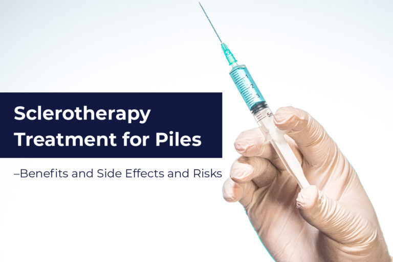 Sclerotherapy Treatment for Piles – Benefits and Side Effects and Risks