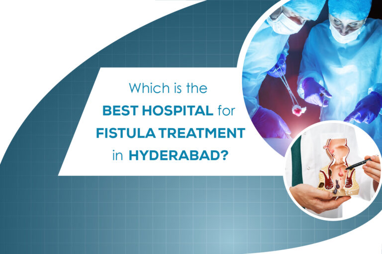 best hospital for fistula treatment in Hyderabad
