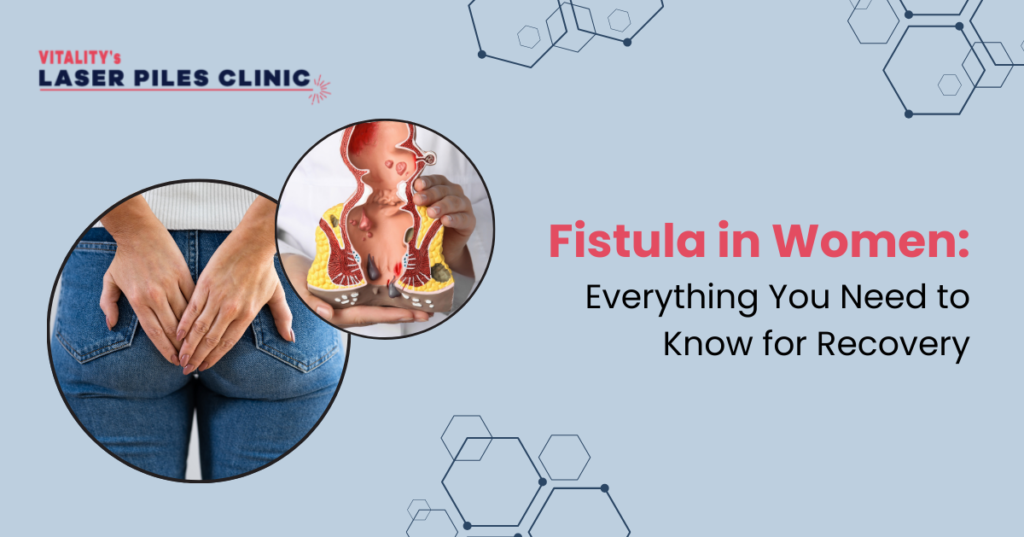 Fistula in women – medical illustration and patient showing discomfort near anal area, Laser Piles Clinic awareness banner