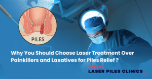 Laser treatment for piles being performed by a medical professional at Vitality's Laser Piles Clinics.
