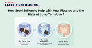 Vitality's Laser Piles Clinics blog banner illustrating the process of how stool softeners treat anal fissures: transforming hard stool into soft stool to stop painful tears and allow healing.