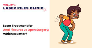Laser Treatment for Anal Fissures vs Open Surgery: Which Is Better?