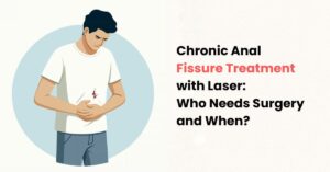 Chronic Anal Fissure Treatment with Laser: Who Needs Surgery and When?